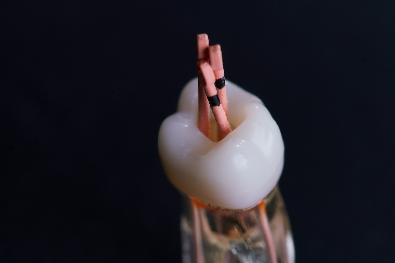 Endodoncija